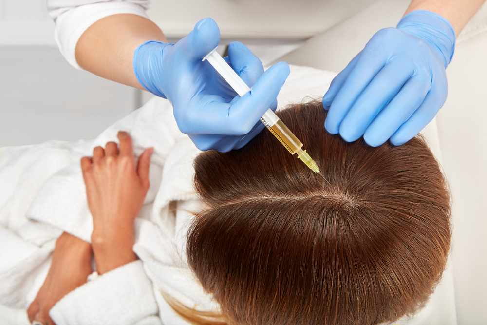 10 Advantages of PRP Hair Treatment: Why It’s a Game-Changer for Hair Loss!